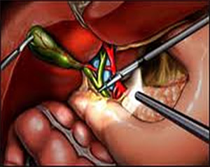 Žlučník Žlučník